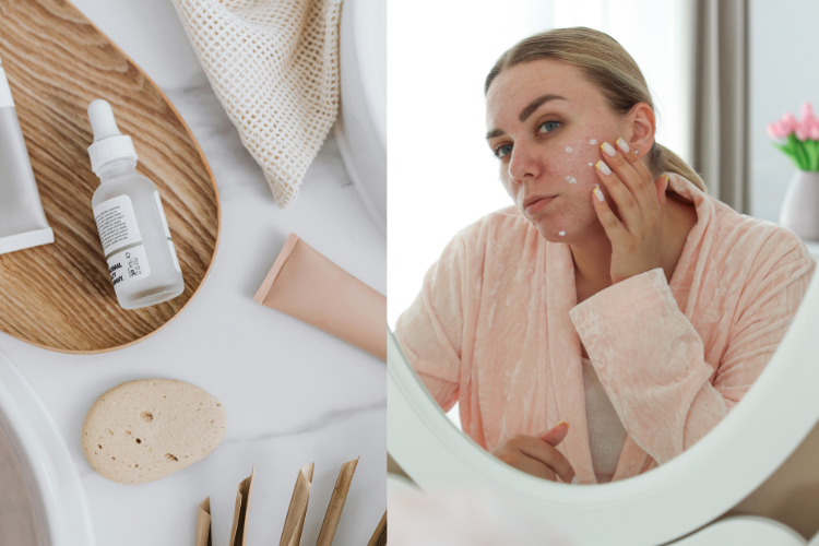 Best Korean Skincare for Acne-Prone Skin (Simple Routine for Clear Skin)